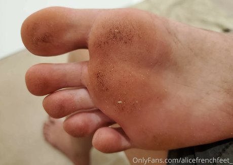 Alicefrenchfeet