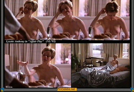 Lysette Anthony