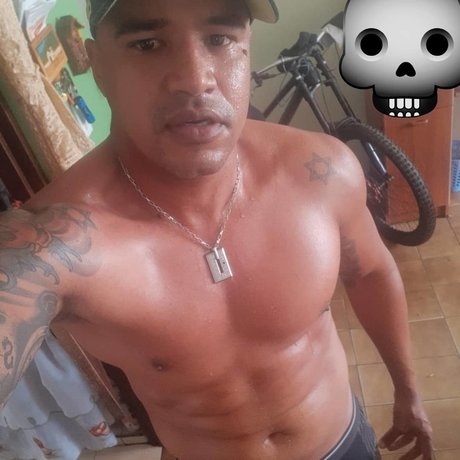 Scar Vive
