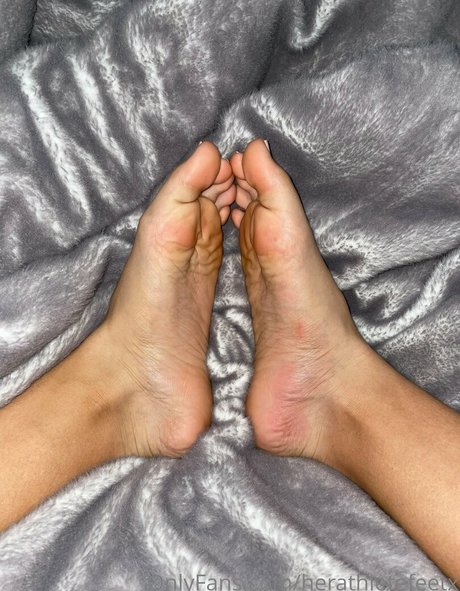 Herathletefeetxo
