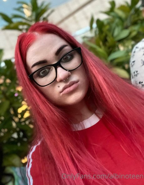 Naakte gelekte OnlyFans-foto van Albinoteen
