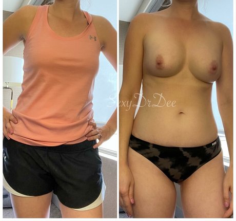 Naakte gelekte OnlyFans-foto van Sexydrdee